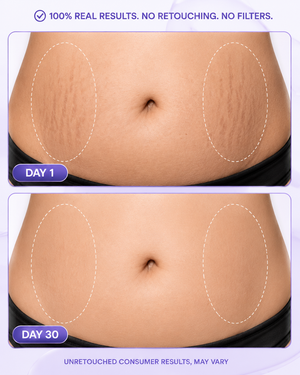 Belly Firming Cream 2