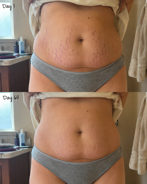 Belly Firming Cream 2
